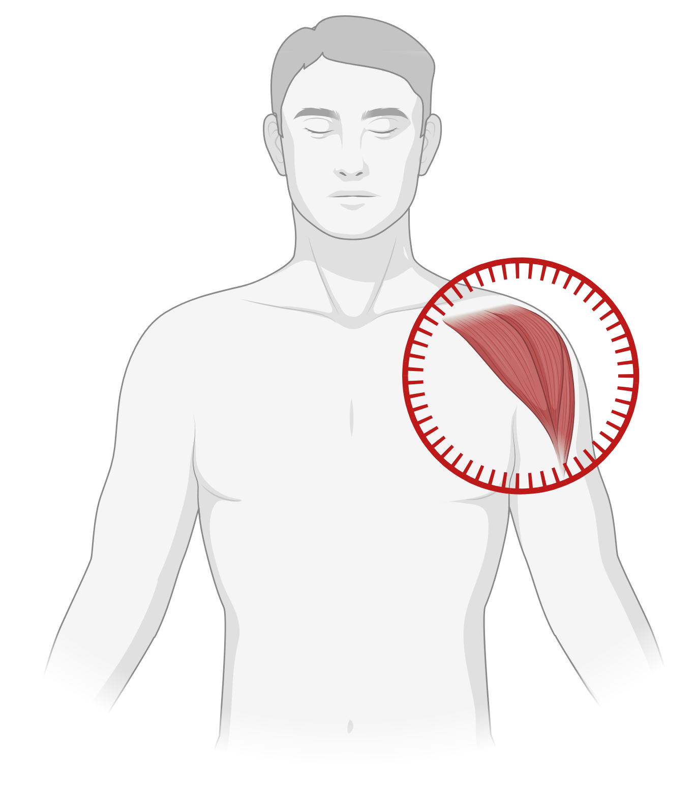Shoulder Pain